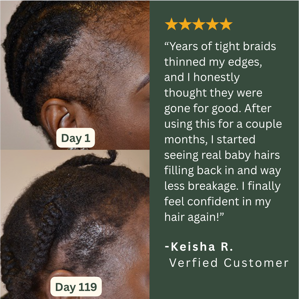 Willo Hair Growth Capsules