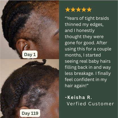 Willo Hair Growth Capsules