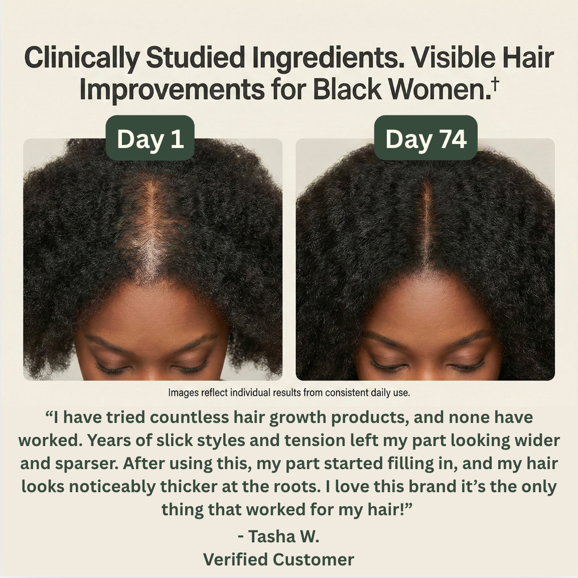 Willo Hair Growth Capsules